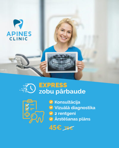 Apines Dental Clinic ad creative